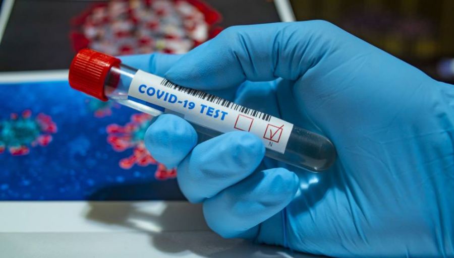 Reasons for Africa’s low COVID-19 rates revealed